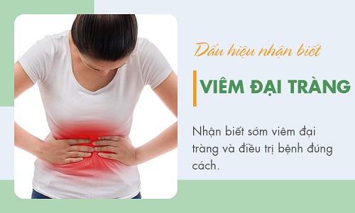 viêm đại tràng