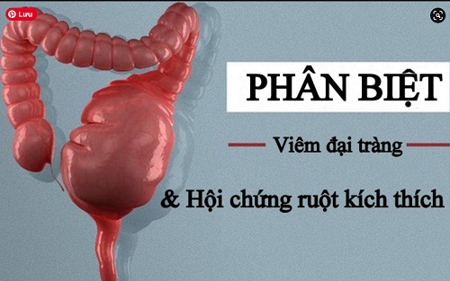 đại tràng co thắt và viêm đại tràng