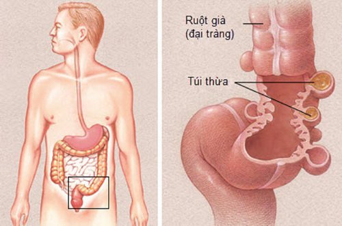 các bệnh về đường tiêu hóa