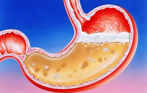 chất nhầy trong dịch vị có tác dụng gì